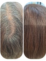 ユーフォルムギンザ(y-Forme Ginza)&nbsp;話題のトキカタ♪頭頂部編