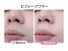 【オシャレプレミアム【光】髭スッキリコース】6050→5500