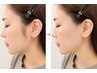 【選べるムダ毛ケア】もみあげ・手の甲&指・足の甲&指 1ヶ所 ¥2,695