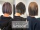 ヘアーブレイス(hair brace)の写真