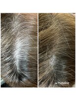 アイビー(IVY)&nbsp;オレンジ撃退の白髪ボカシ［髪質改善/縮毛矯正/ヘナ/千葉駅］