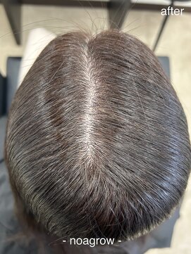 ロハスヘア バイ ノット(rohas hair by knot) ノアグロウスカルプ