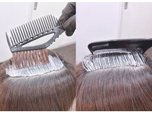 《薬剤・技術へのこだわり》