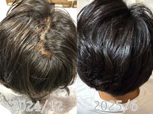 コエバイロゼオ(coe by Roseo)の雰囲気(話題の真空ヘッドスパ!久米川随一のサロン!)