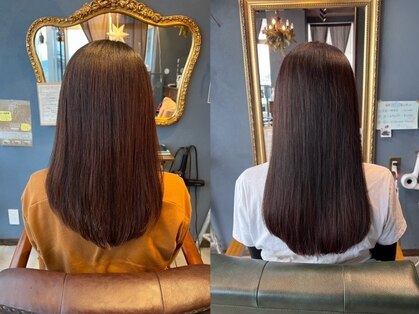 ロイムプラスイー(RoimU+e)の写真