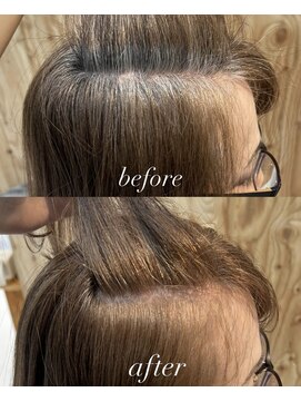 白髪ぼかしビフォーアフター