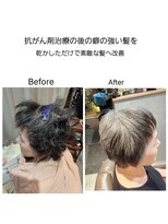 髪質改善 ソアリス 烏丸丸太町店(soiris)&nbsp;40代抗がん剤治療後の強い癖の髪　悩みにはサードTR