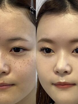 ハンナヘア(hanna hair) 韓国陶器肌メイク