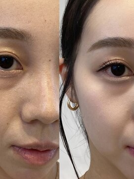 ハンナヘア(hanna hair) 韓国女優メイク