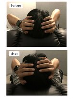 ボンド(hair salon bonD)&nbsp;ドライヘッドスパ＋マイクロバブル75分　￥6,050 