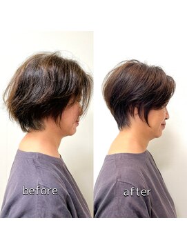 テルミークリニカルデザイン 北千里 50代ショートビフォーアフター