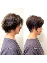 テルミークリニカルデザイン 北千里 50代ショートビフォーアフター