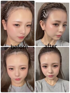 ヘアアトリエオット(hair atelier 8 otto) ヘアライン修正
