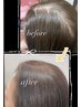女性“エクソソーム”の【頭皮ケア】カウンセリング０円