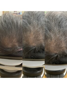 ヤスイ(YASUI) 頭皮ケア体験