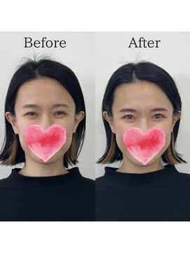 レトア(Letoa) ビフォーアフター