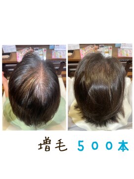 アート(Art) ふんわりヘアーに変身♪