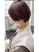 ライラ(LAILA) Before after