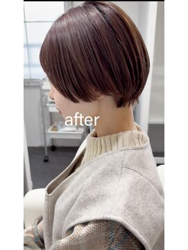 ライラ(LAILA) Before after