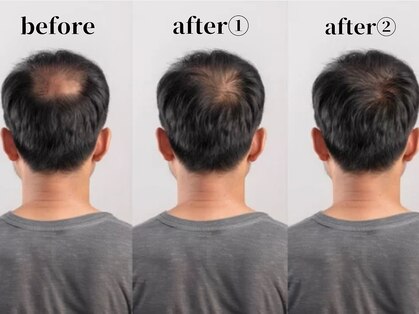 ラソヘアー(Lazo hair)の写真