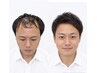【CUT|プレミアムカット】カット+クレンジング+育毛促進頭皮ケアフル