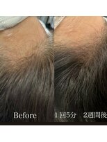 髪質改善 ソアリス 烏丸丸太町店(soiris)&nbsp;髪育トリートメント