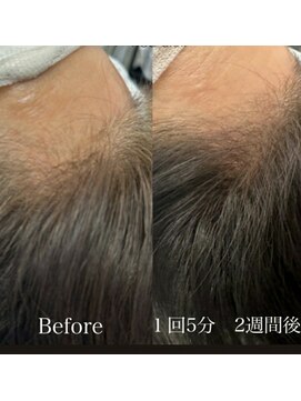 髪質改善 ソアリス 烏丸丸太町店(soiris) 髪育トリートメント