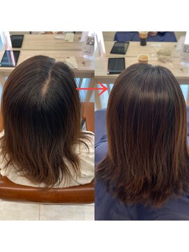 アメリア(ameria) 【30、40代必見】つむじ割れを解消して若々しく☆長岡×表参道