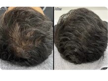 エレガンス(ELEGANCE)