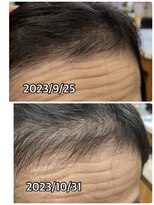 エミ(EMI)&nbsp;育毛促進