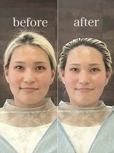 ヘアホスピタル ファニーフェイス(HAIR HOSPITAL funny face) 骨格補正ヘッドスパ・小顔矯正