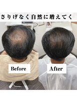 アンフィーロ(An filo)&nbsp;増毛エクステ（ヘアループ）800本
