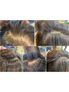 ファッションカラーで染める人気の白髪染め◎白髪を染めるだけじゃない。あなたらしく、大人の美しさをー