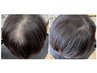 【前髪・つむじの割れで悩みの方必見！】毛根矯正・ヘアリセッター※ブロー別