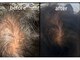 エルモ 北千住(Elmoo)の写真/【毛量・髪のボリューム】でお悩みの方へ。韓国最先端美容技術を用いた育毛促進メニューを新たに導入☆