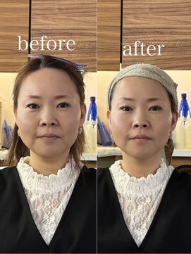 ヘアホスピタル ファニーフェイス(HAIR HOSPITAL funny face) 骨格補正ヘッドスパ・小顔矯正/暗めカラー/ミディアムヘア倉敷