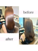 アールサロンプラスキャスパ 自由が丘(Rrsalon+CASPA) 【最新】R.HAS XE(エクソソーム)人幹細胞水素トリートメント