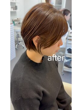 ライラ(LAILA) Before after