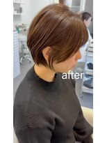 ライラ(LAILA) Before after