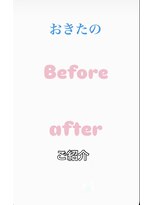 ライラ(LAILA) Before after