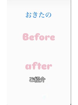 ライラ(LAILA) Before after