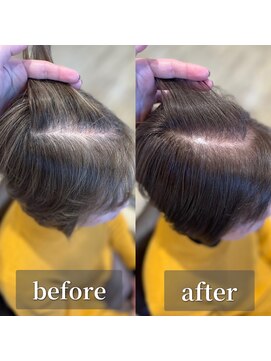 シンズ 仏生山店(SHIN'S) 白髪ぼかしカラーbefore/after