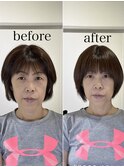 骨格補正ヘッドスパ・小顔矯正