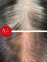 エーサロン(Aサロン)