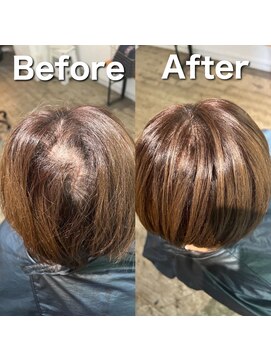 ツムグ 代官山 中目黒(TUMUGU) 地肌見え・つむじ割れ解消/ボリュームアップエクステ