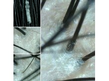 エメ(aime)の雰囲気（頭皮クレンジング）