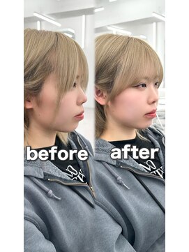 アマトウキョウ アユンチェ(AMA TOKYO×AYUNCHE) 前髪顔まわり韓国ヘアレイヤーカットサイドバンク2wayバンク韓国