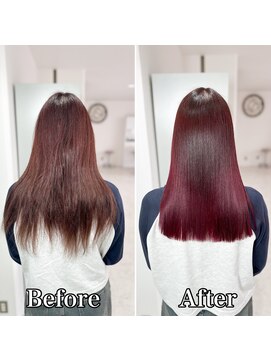 エセット(ECET) ECET式ストレート