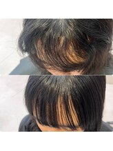 縮毛矯正before→after☆画像加工なし実際のお客様お写真です《縮毛矯正/髪質改善/髪質改善カラー/恵比寿》