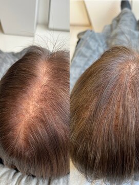 ヘアプラスオオサカ エアリーエクステンション